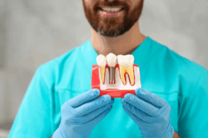 Dental Implants