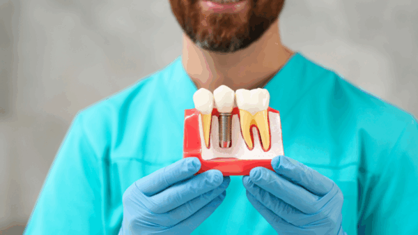 Dental Implants